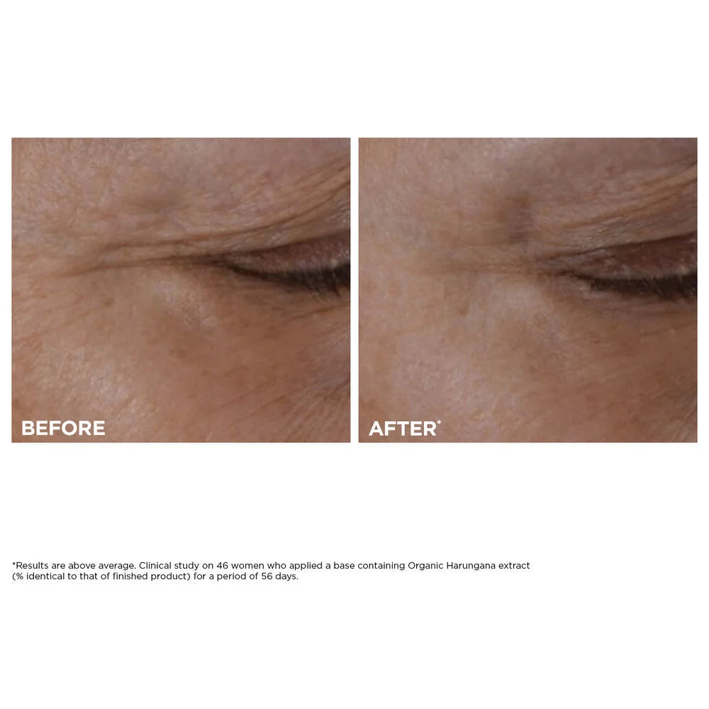 Total Eye Lift Refillable Eye Cream for Firming, Wrinkles, Dark Circles + Puffiness