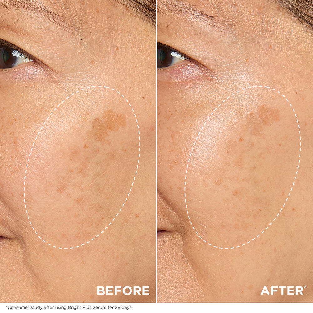Bright Plus [Advanced] Serum - Brightening+ Dark Spot Targeting Serum