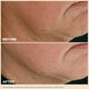 Extra-Firming Day Refillable Moisturizer with Collagen Polypeptide + Niacinamide