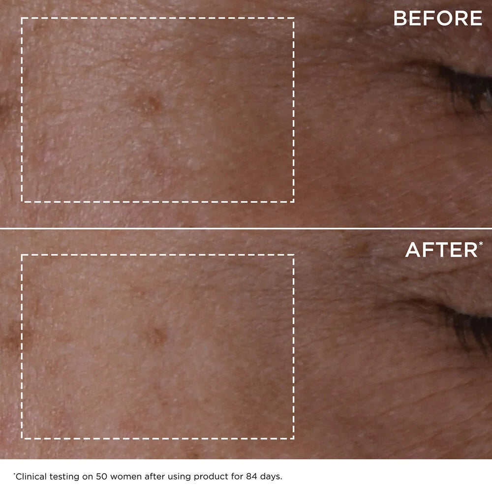 DOUBLE SERUM® - Anti-Aging + Anti-Wrinkle Serum