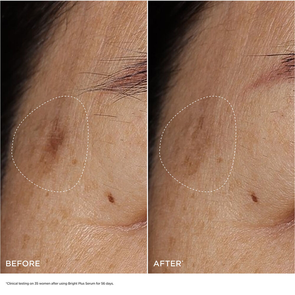 Bright Plus [Advanced] Serum - Brightening+ Dark Spot Targeting Serum