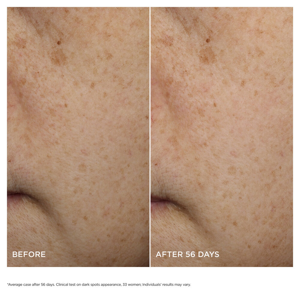 Bright Plus [Advanced] Brightening Moisturizing Milky Emulsion